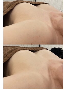 レナブルーム(Renabloom)/即実感♪