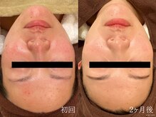 ウォーム(warm)/【肌質改善専門店warm】肌質改善