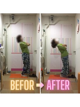みずき整骨院 骨盤本舗/BEFOR/AFTER