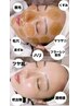 【肌質改善☆】マツヤニWAXでつるんと卵肌に♪
