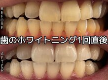 ヴィオール 名古屋栄店(VIOR)/身体に優しい成分を使用♪