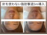 人気No4♪【速攻小顔＆後戻り無】針を使わない脂肪分解導入!小顔フェイシャル