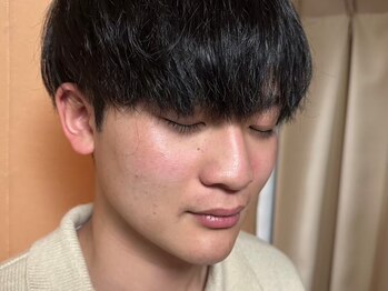ヒゲ革命 難波日本橋の写真/【日本橋/なんば】清潔感UP!＆若々しい印象になるひげ脱毛が大人気☆痛みも少なく気軽に通えます♪