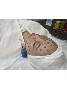 お肌をきれいにしたい