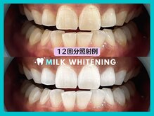 ミルクホワイトニング 新大村店(Milkホワイトニング)/★施術例