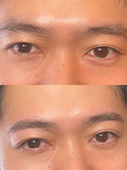 ティーアール(TR)の写真/【メンズ眉毛×清潔感】女性目線で整える、さりげない“かっこよさ”を。第一印象を決める垢抜け眉へ！