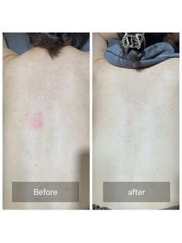 グレイス(Grace)/オイリーな場所こそシンプルに☆