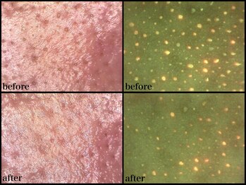 ベベ 目黒店(Be'be')/マイクロスコープで毛穴確認