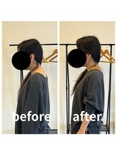 熊本カワル整体 JR上熊本駅院/ストレートネック