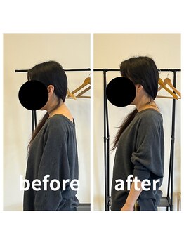 熊本カワル整体 JR上熊本駅院/ストレートネック