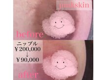 ピピランチェ(PIPIRANCHE)の雰囲気（産後の黒ずみなどにも◎新しいメラニン除去ケア【ピンクスキン】）