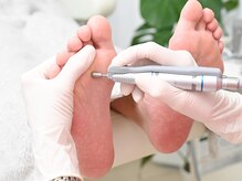 フットメンテ 巻き爪矯正センター 南浦和/４、施術の流れ　