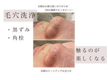 ネージュ(Neige)/毛穴洗浄1回