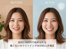 シェル(SHELL)の雰囲気(1度で効果を実感できる施工方法を丁寧にアドバイスいたします。)