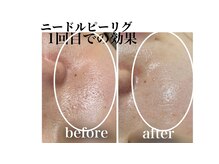 ラ ヴォーテ(La beaute)