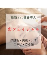 キレイシェア バイ プリンセスローズ静岡駅店(KIREI SHARE)/顔脱毛