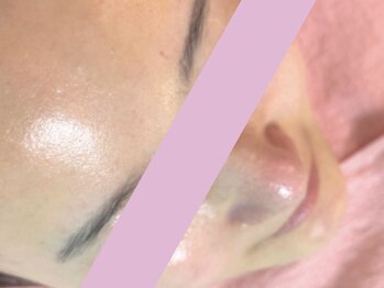 ジェリー(JERRY)/ツヤツヤ