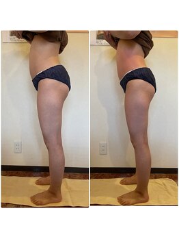 アールビーシー(RbC)/