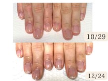 シープラス/ジェルで爪をもっと綺麗に育成