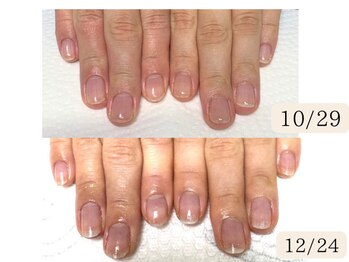 シープラス/ジェルで爪をもっと綺麗に育成