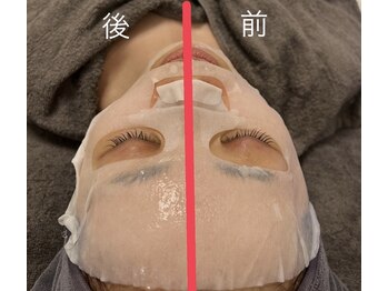 ソルル(SOLULU)/むくみすっきり☆