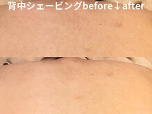 ももとゆでたまご/背中シェービングbefore↓after