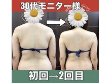 スワン 新栄店(SWAN)/【30代モニター様】初回→2回目