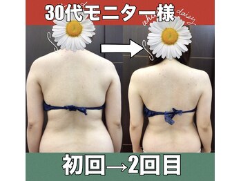 スワン 新栄店(SWAN)/【30代モニター様】初回→2回目