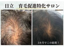 ソナヴォート(Sun Vuoto)