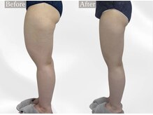 プリマルーチェ/プレミアム下半身プログラム