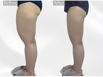 プリマルーチェ/プレミアム下半身プログラム