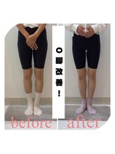 スタイルラボ高松/O脚矯正の効果♪