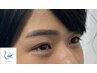 《メンズ眉毛》平日限定学割U24美しい眉スタイリング×鎮静パック×眉美容液
