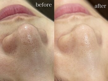 テオリア(TEORIA)/