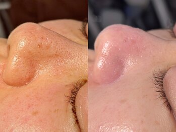 ルーナジェーナ(Luna llena)/