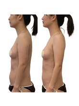 ベンザイ 新潟店(BENZAI)/肩こり首こり！パソコン疲れ