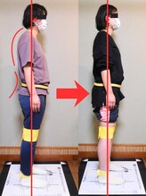 チャラク(charaku)/【30代S様：ストレートネック】