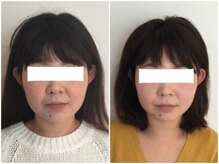 美容整体 ウェリナ 蟹江院/小顔矯正/骨盤矯正/美脚サロン