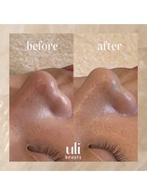 ウリ(uli beauty)/比較写真