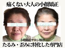 顔凛(カオリン)