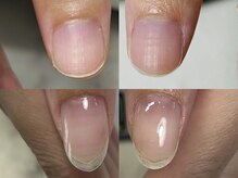 ハッチネイル(HACCI nail)