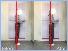 トロ整骨院(toro整骨院)/骨盤矯正★1回の効果★20代女性