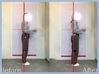 トロ整骨院(toro整骨院)/骨盤矯正★1回の効果★20代女性