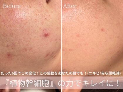 テン(10ten)の写真