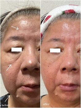 ヒルナム(Heal Nam)/やばいオールインワンケア