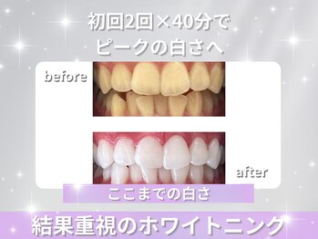 ホワイトニングショップ 四条店