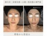 【温め×巡り×引き締め×小顔】　高周波+空気圧+小顔コルギ