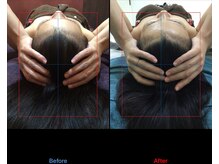 ルル(Lulu's)/トリムヘッド5回目施術結果