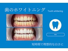 ビアン(Bian)の雰囲気（短時間で自然な白さへ導きます◎）