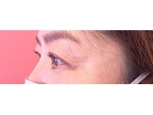 ラス 方南町駅前店(LATH)/7月★まつ毛